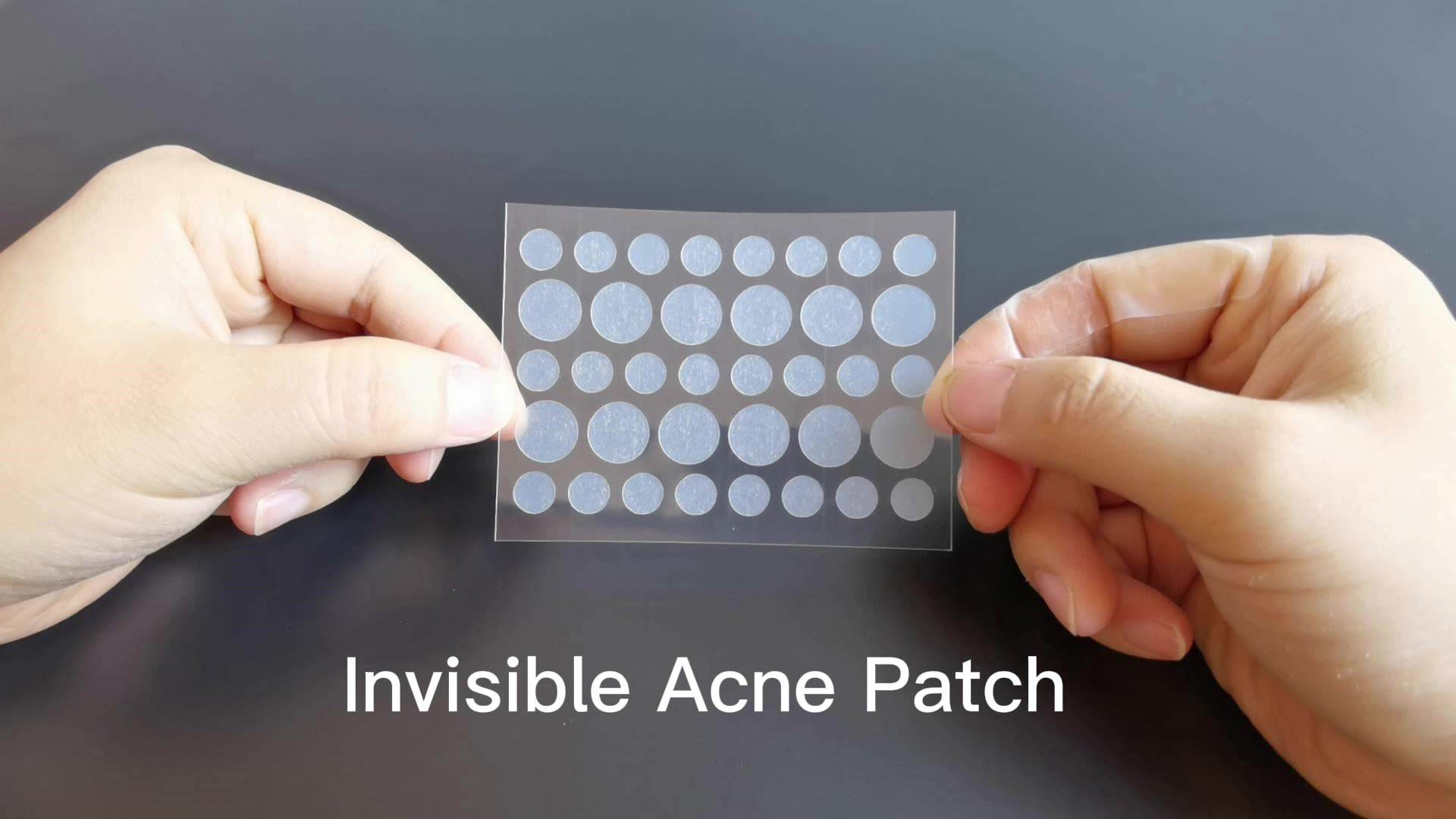 acnepimple区别 acne pimple区别 